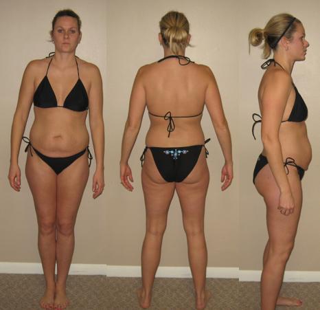 Alisha McGinn First Venus Index Transformation Before