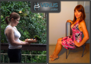 Kirsty side 2 before and after Venus Index smaller