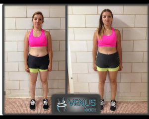Venus Laura Front Before and After
