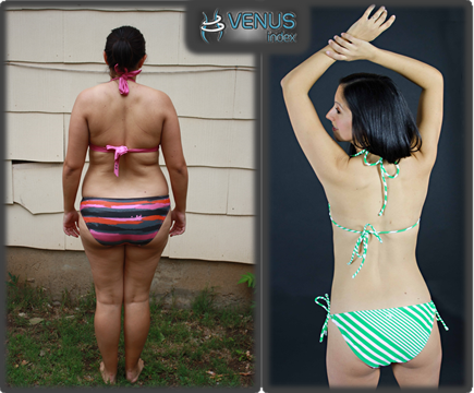 Carly Venus Before and After Back