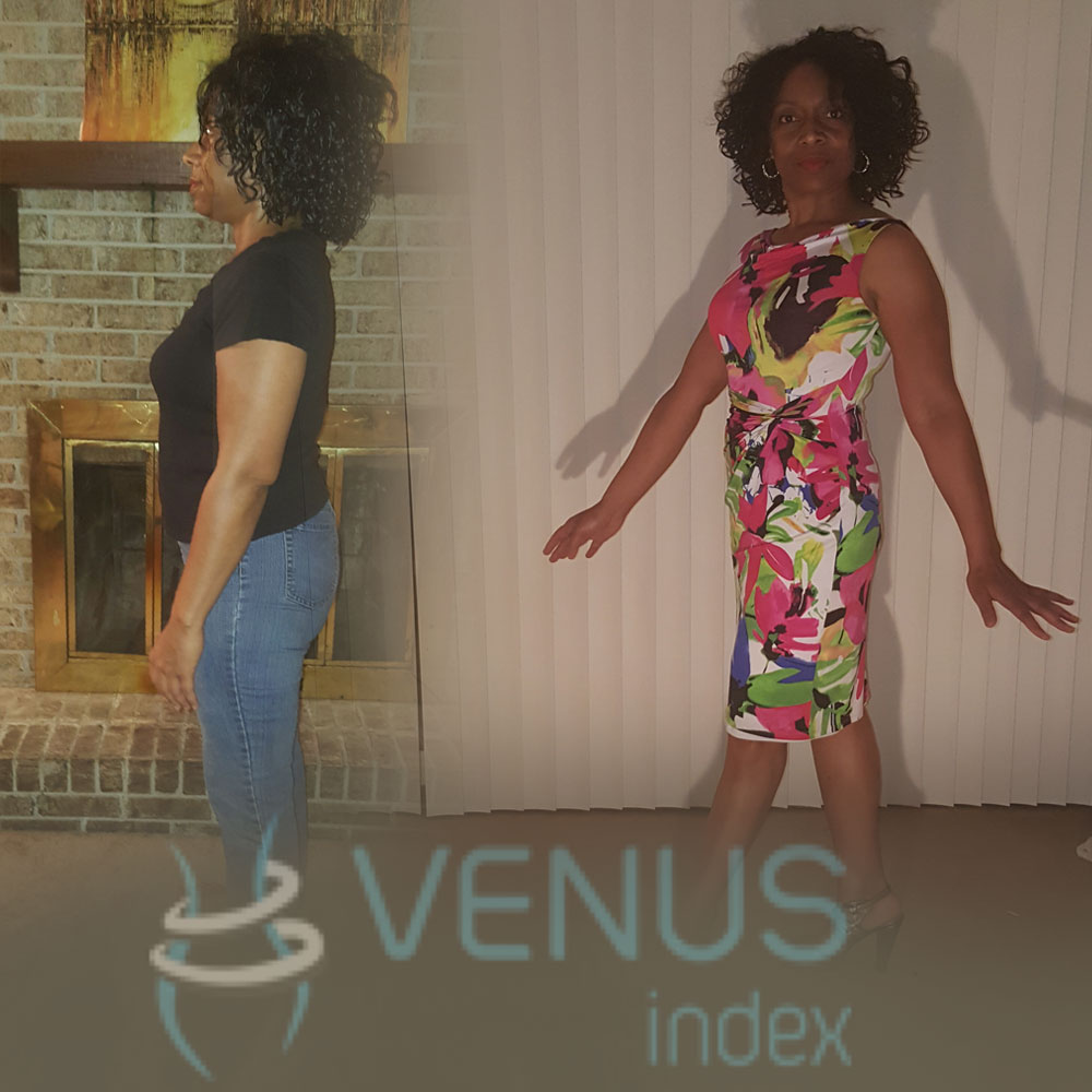 " I actually have only begun. I look at my after pictures with great pride, realizing the hard work and determination it took to get to where I am today. I will continue to eat clean and exercise, and to commit to the Venus lifestyle. Thank you for this incredible program."